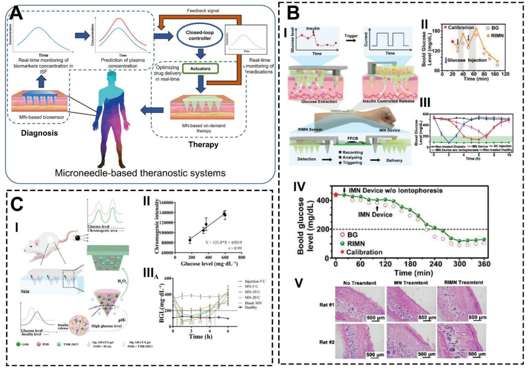 Microneedle theranostic systems