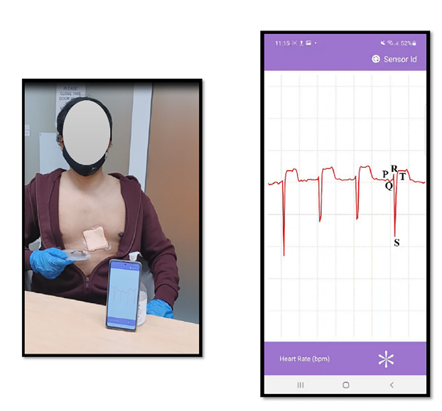 3-lead ECG sensor based on hexagonal maze design with wireless communication