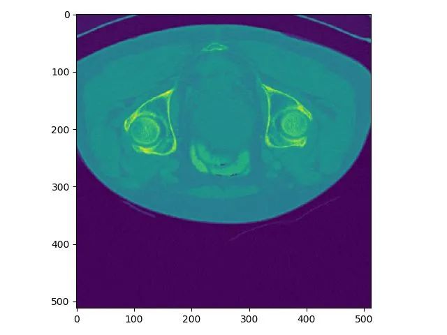 Same slice visualized in ITK-SNAP
