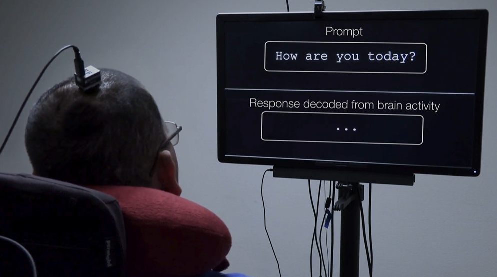 Brain–Computer Interface Decodes Silent Spelling in Paralyzed Patient
