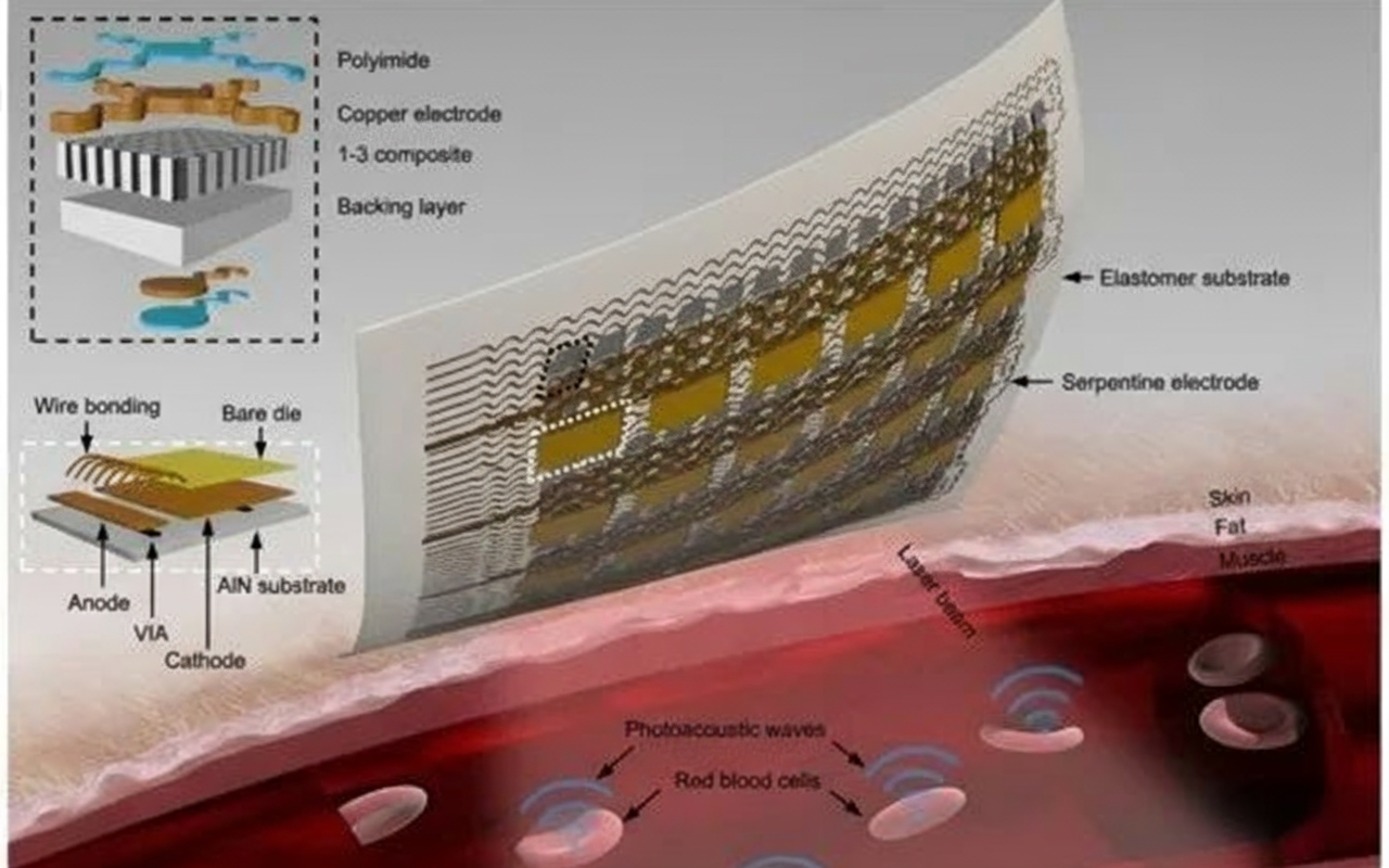 Wearable photoacoustic patch structure and operation