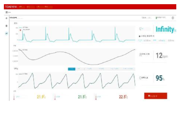 GUI showing ECG, PPG, pacemaker pulses, heart rate, and skin temperature