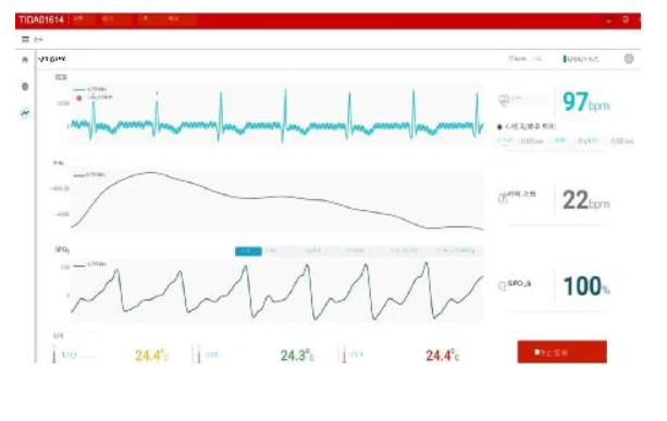 GUI showing ECG, PPG, respiration, heart rate, and skin temperature