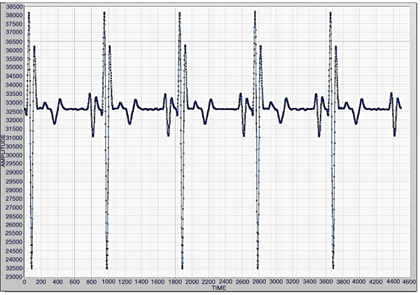 ECG output at 60 BPM showing component compatibility