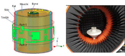 Definition and Characteristics of Flexible Wearable Antennas