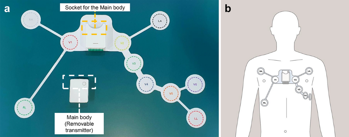 Design and Testing of a Wearable Wireless ECG Recorder