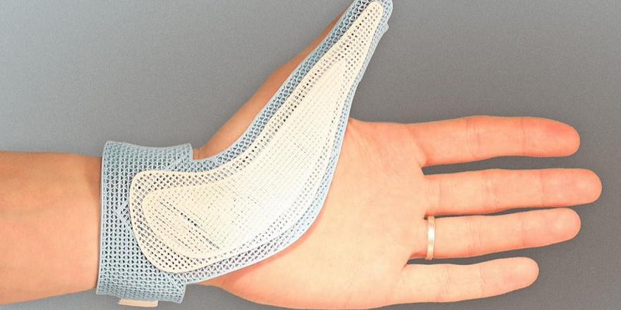 3D-Printed Medical Splints: NovaCast