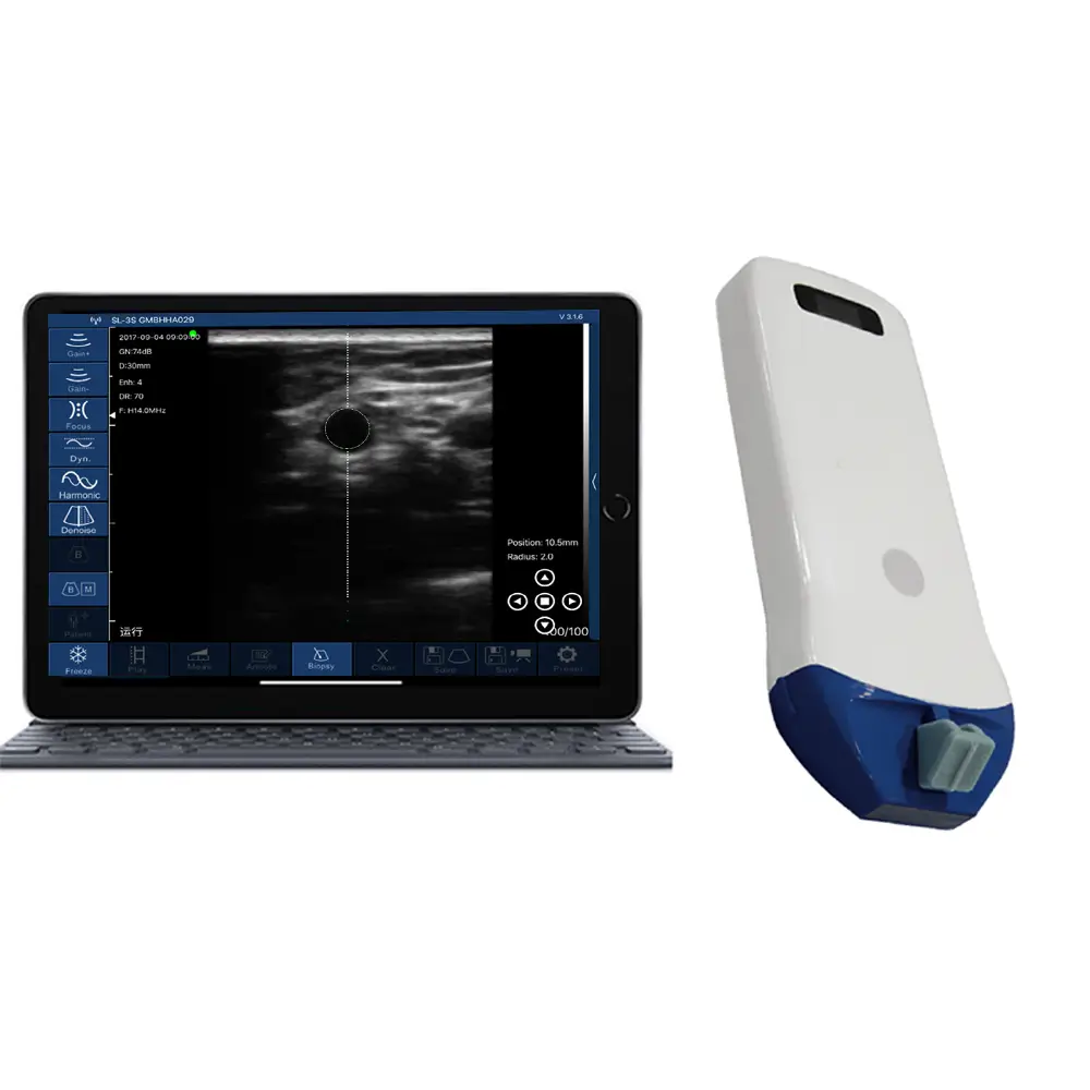 Ultrasound Smart Probes: From Trolley to Handheld