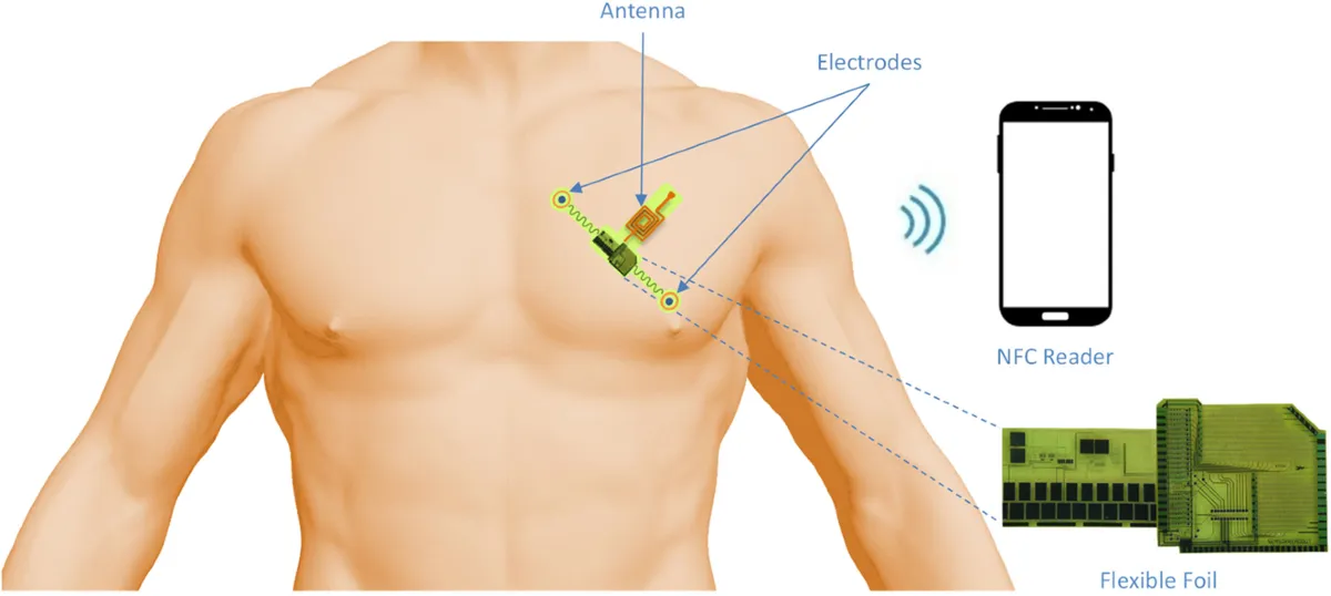 Skin-integrated PPG-ECG patch