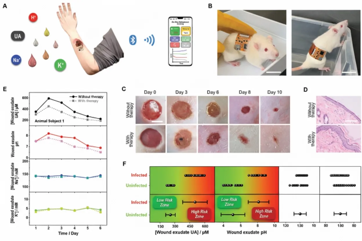Validation of the dual-function fully integrated wearable tracker for on-site wound exudate monitoring and potential wound management