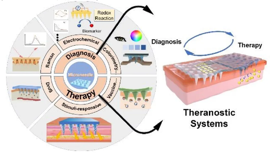 Microneedle Biomedical Systems: Design and Applications