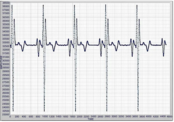 ECG output at 60 BPM showing component compatibility