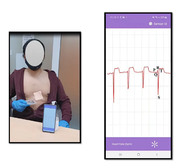 3-lead ECG sensor based on hexagonal maze design with wireless communication