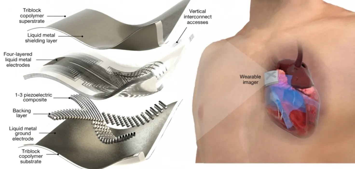 Wearable Ultrasound Sensor for Real-Time Cardiac Assessment