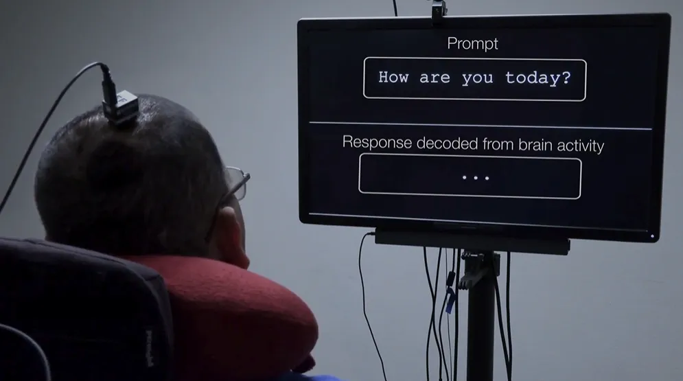 Brain–Computer Interface Decodes Silent Spelling in Paralyzed Patient