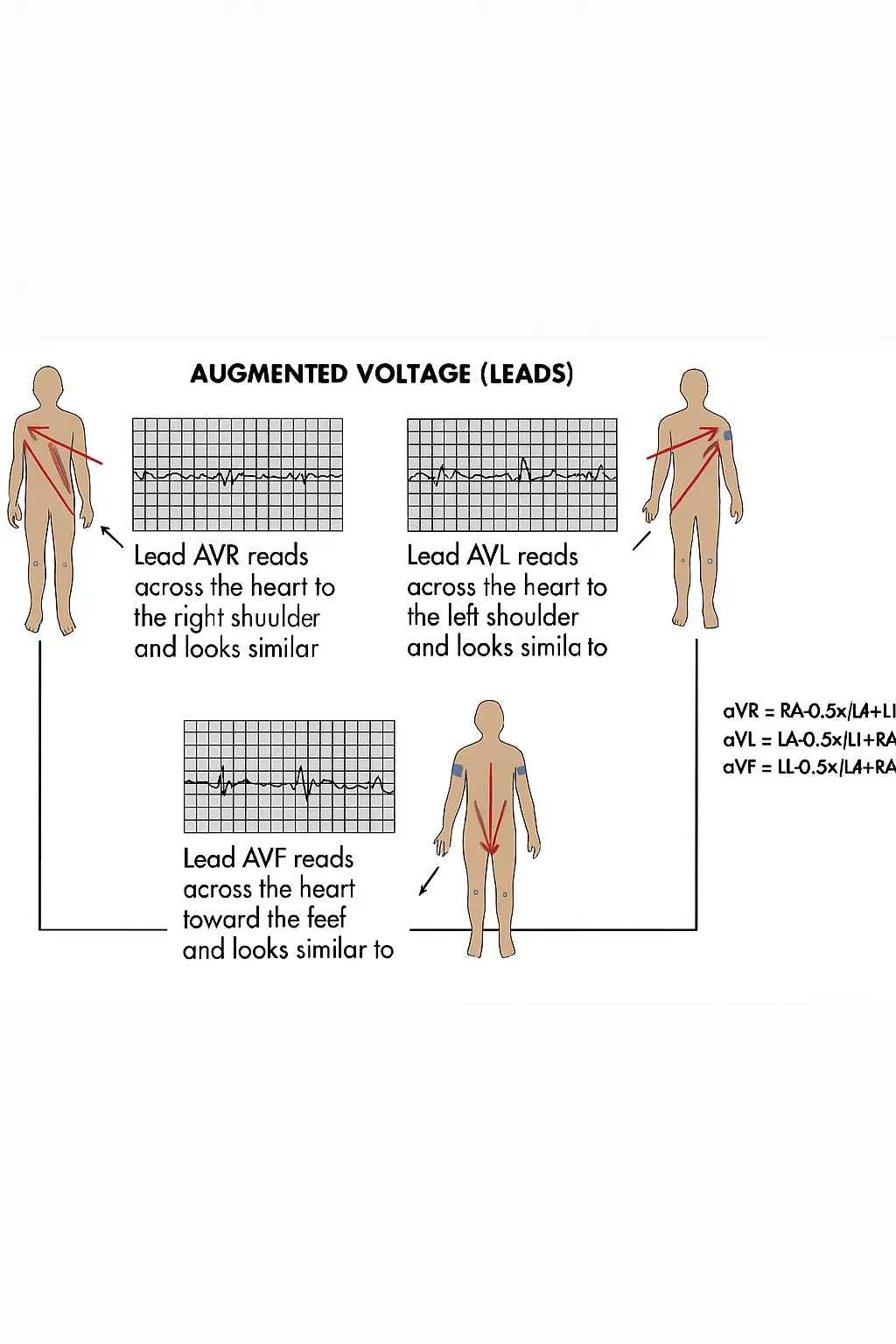 aVx lead measurements across the heart