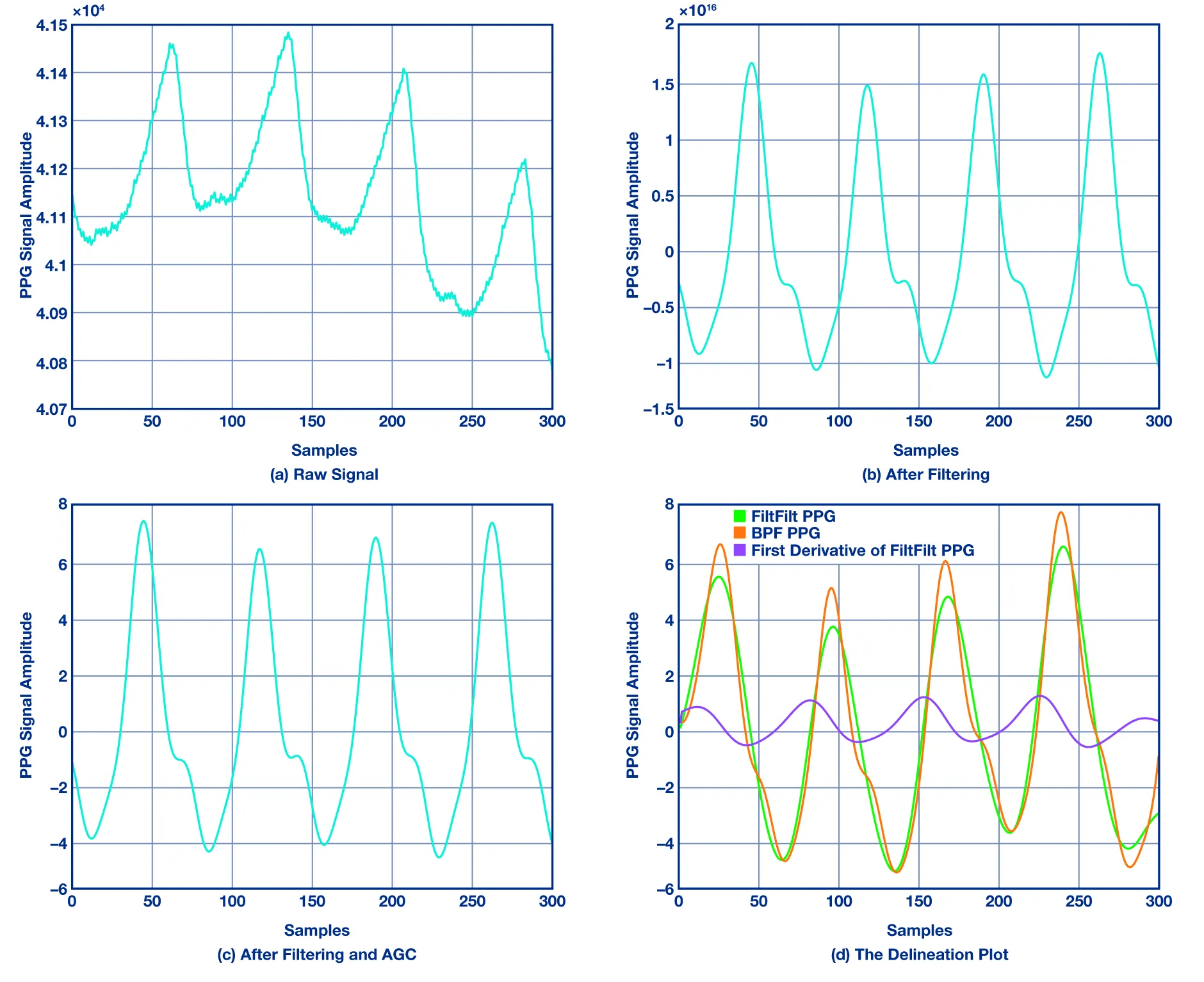 PPG Preprocessing Steps and Filtering