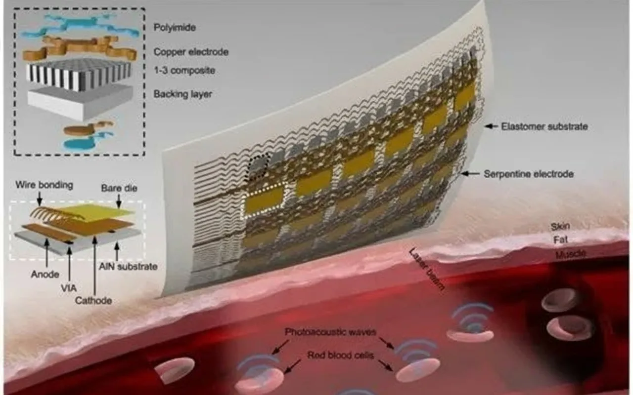 Wearable photoacoustic patch structure and operation