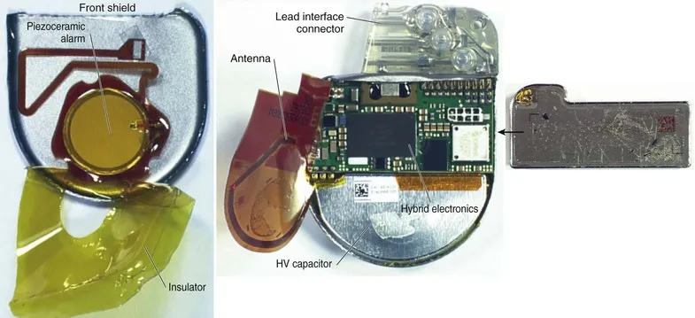 Pacemaker device showcasing internal biocompatible PCB design