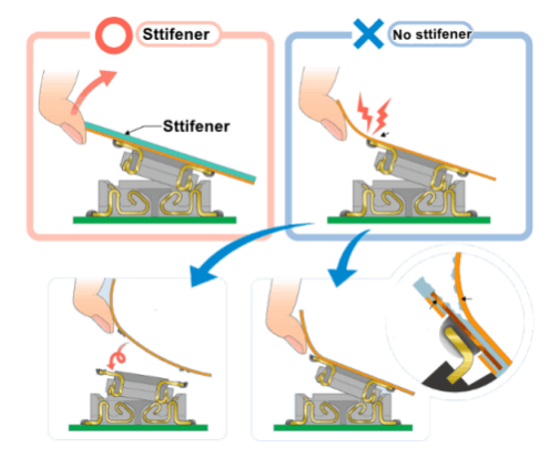 mechanical support