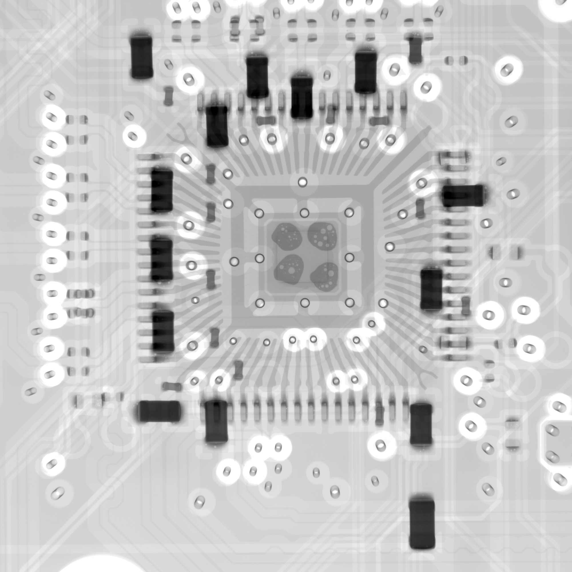 CT scanner with visible PCB components for medical imaging.