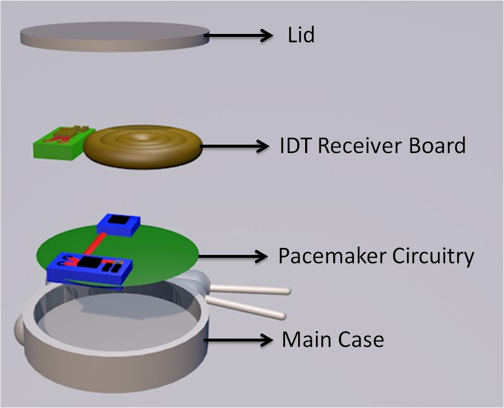 pacemaker components