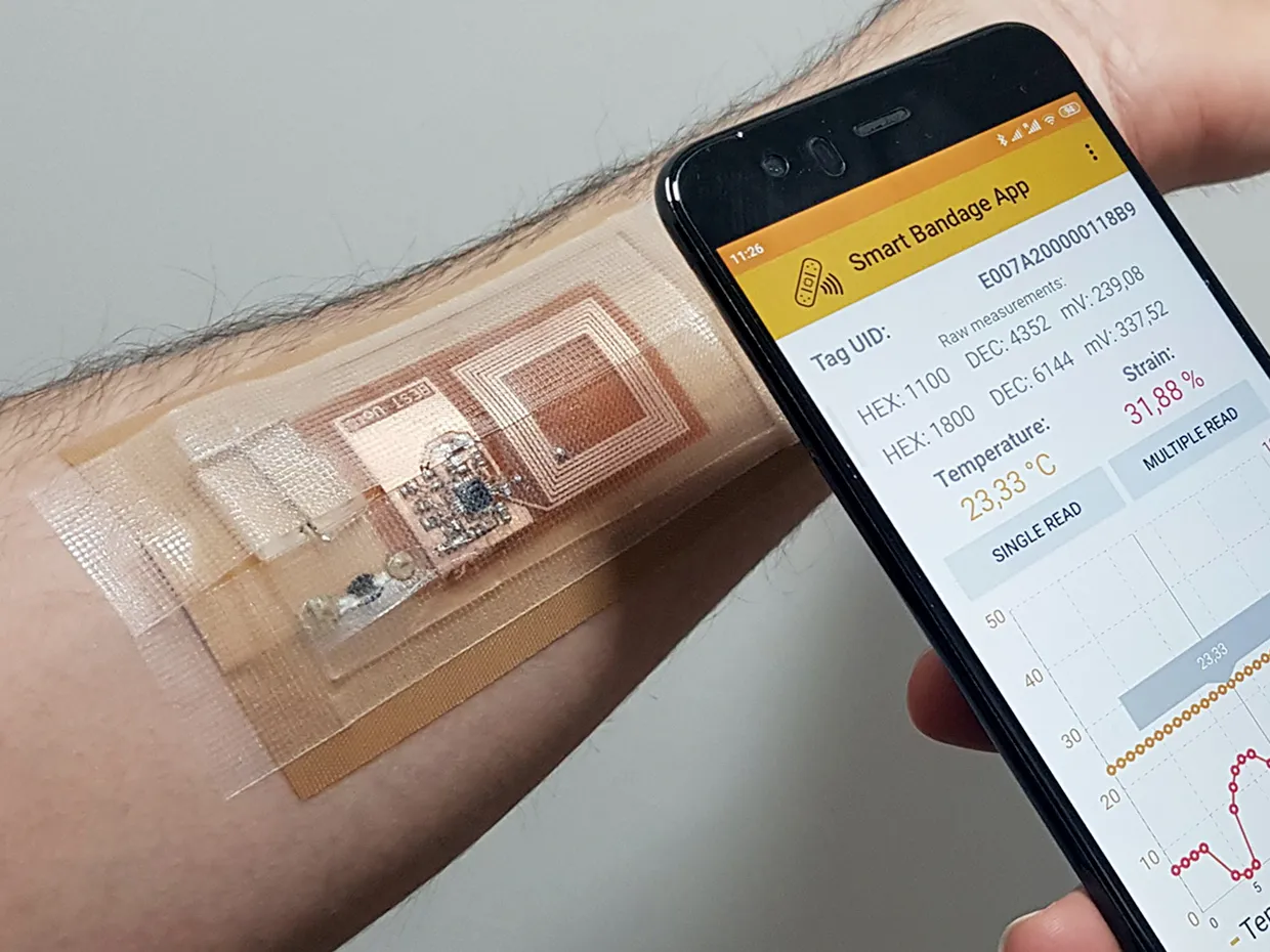 Smart bandage with flexible PCB for wound monitoring
