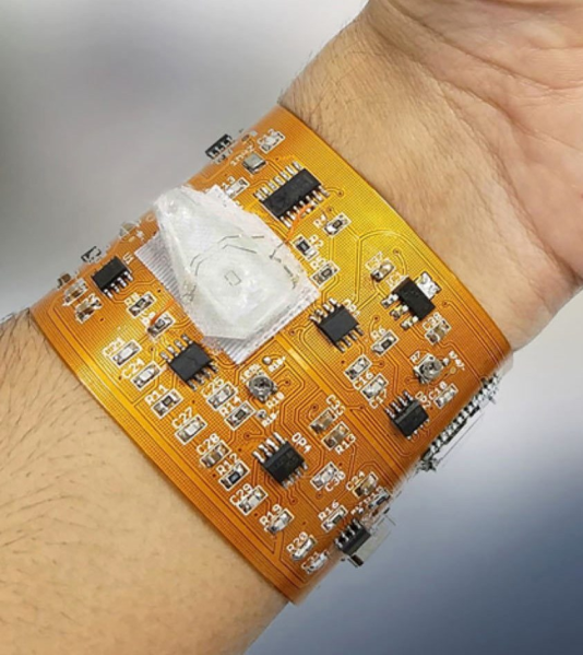 Comparison of dynamic flex PCB in a wearable and static flex PCB in a medical device.