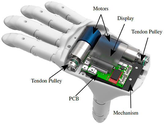 Prosthetic device PCB components in a modern design"