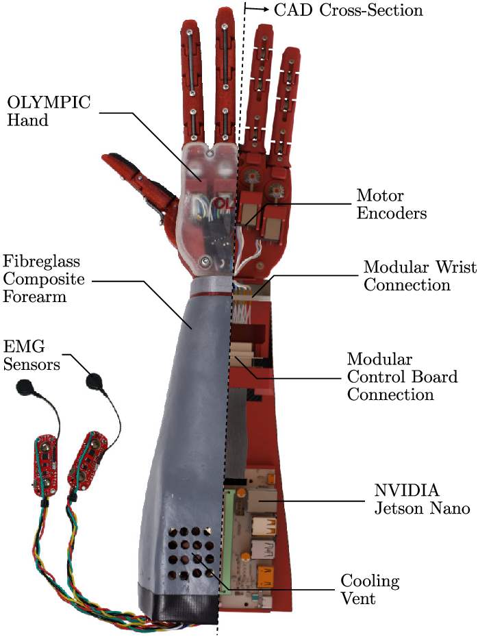 Electronic components for prosthetics in a robotic hand"